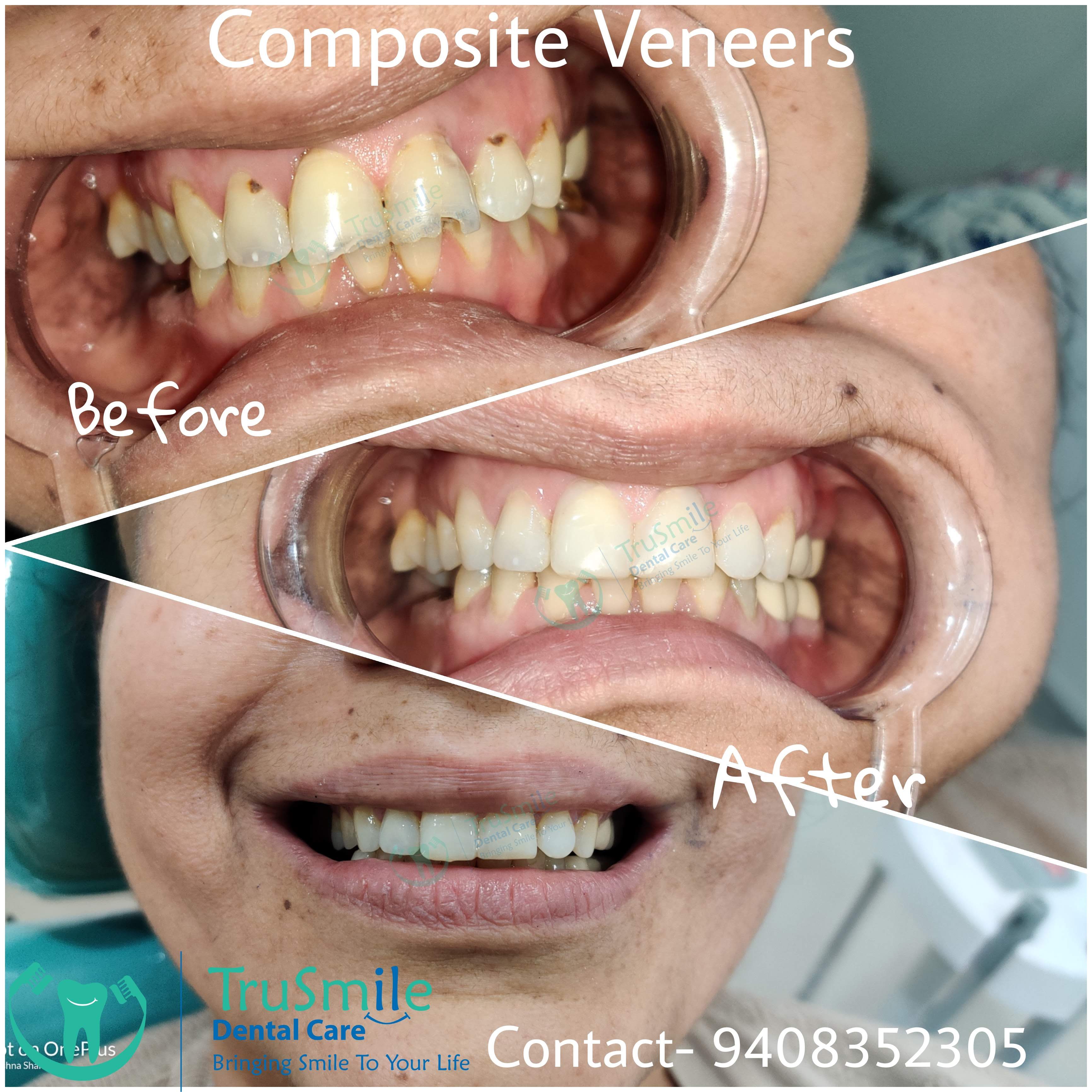 Smile Design 9